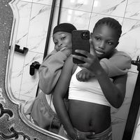 girlwithbirthmark0