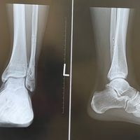neymal99