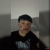 ball_sertdam