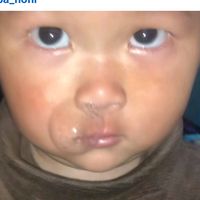 utlimbu4