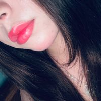 Eres