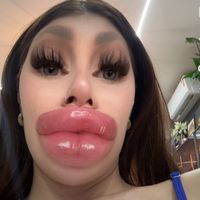 thaisreolon