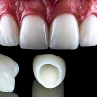 abledentalcare235