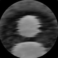 mcrtx1
