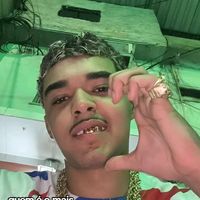 mg_rlk5