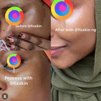 original sound - fixskin.ng