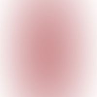 repost.video_acc