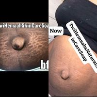 twihemaahnaturalskincare
