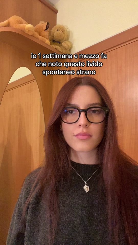 TikTok video thumbnail by aangelicaalino