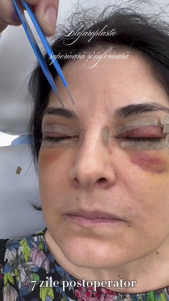 TikTok video thumbnail by dr.levymedicalcenter