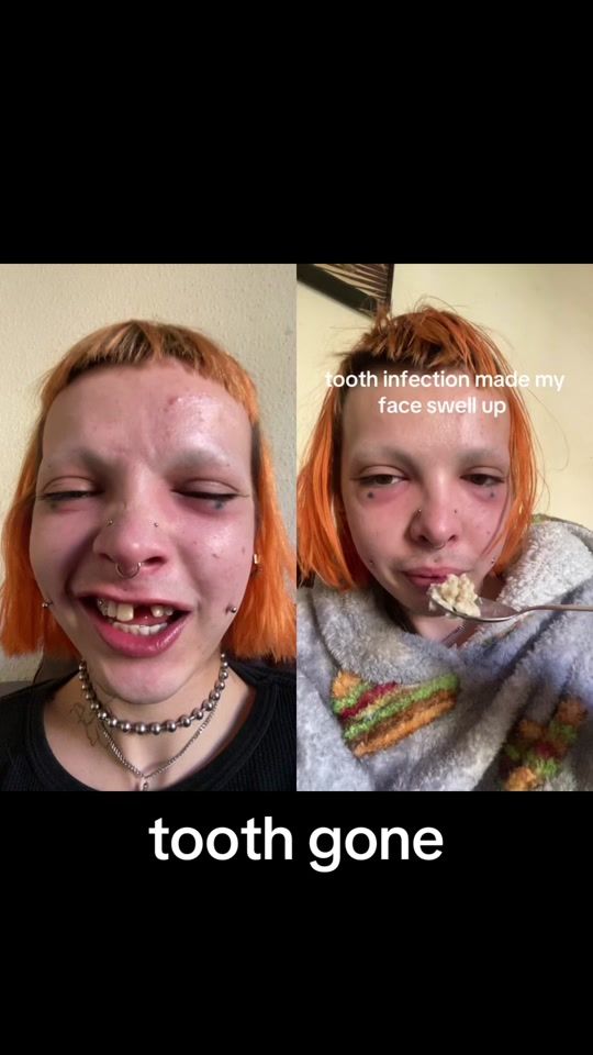 TikTok video thumbnail by aflef
