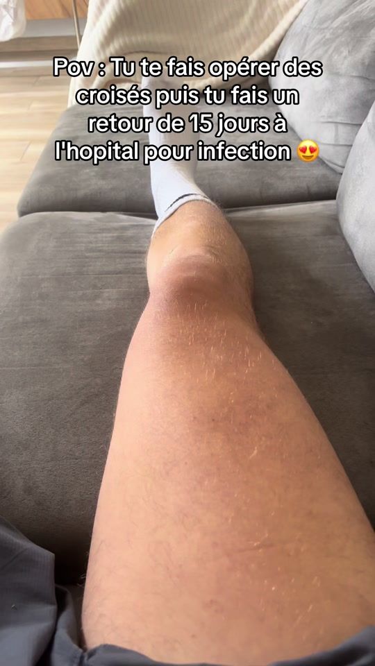 TikTok video thumbnail by regarde_un_prof