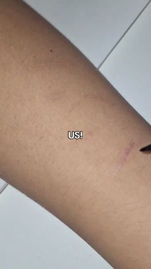 TikTok video thumbnail by kys..rawh