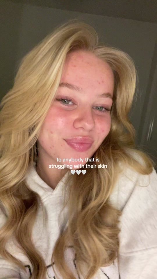 TikTok video thumbnail by erin.wilsonnnn