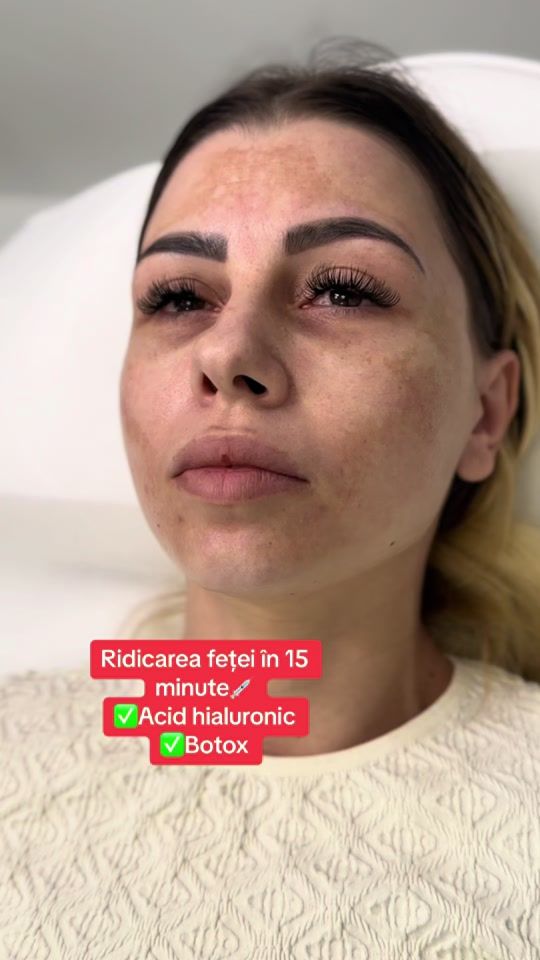 TikTok video thumbnail by marhabaaesthetic