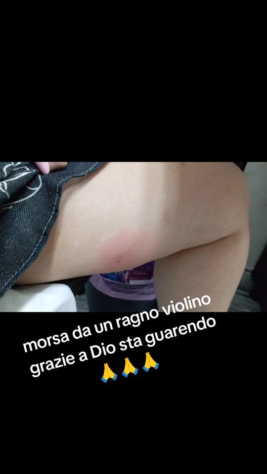 TikTok video thumbnail by occhionegrazia2profilo