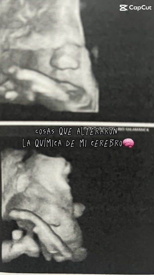 TikTok video thumbnail by alesarmientoh