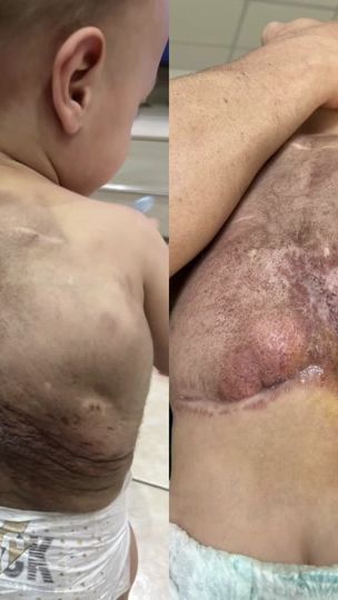 TikTok video thumbnail by vincenzocasella27