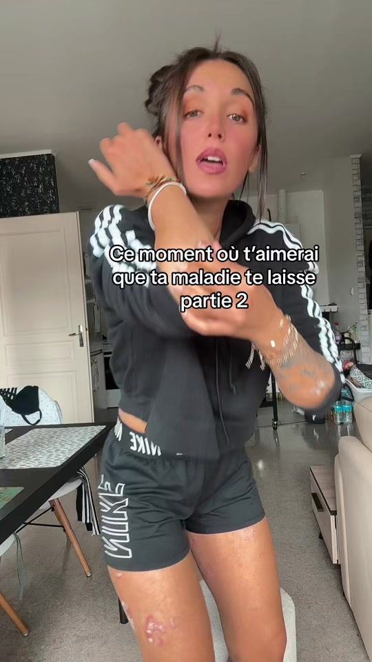 TikTok video thumbnail by lyla_psoriasistyle