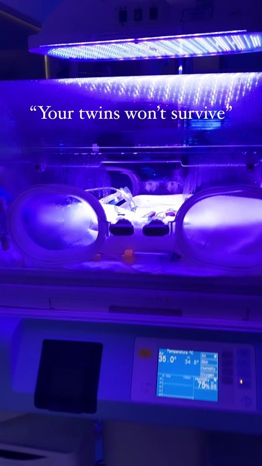 TikTok video thumbnail by twins22weeks