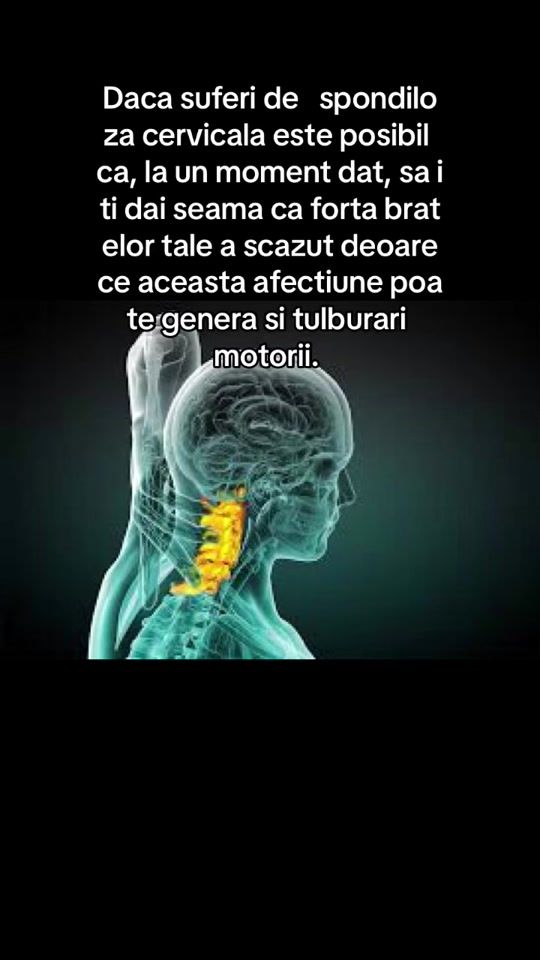 TikTok video thumbnail by physioraluca