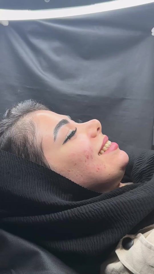 TikTok video thumbnail by dz.hollywood.smile