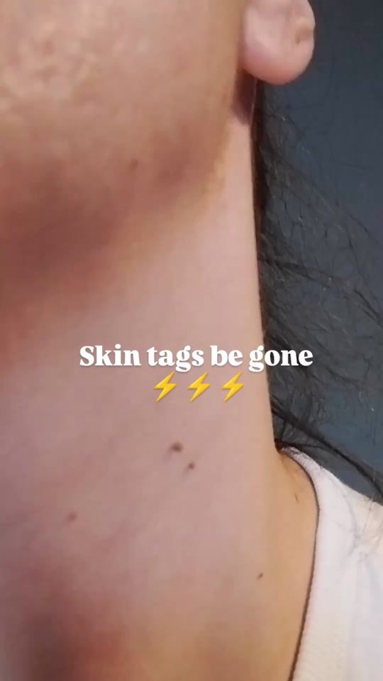 TikTok video thumbnail by tagband