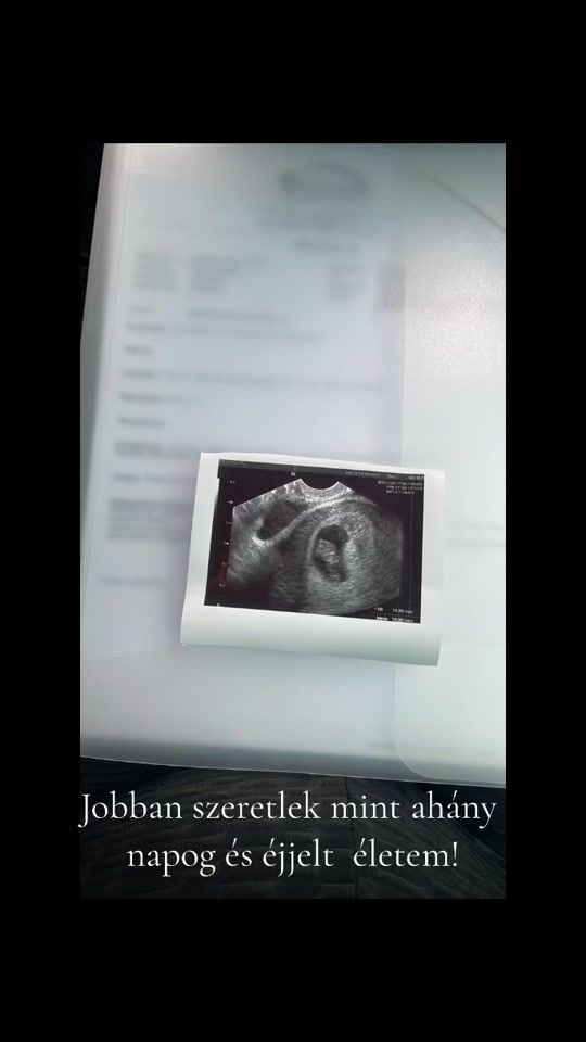 TikTok video thumbnail by amina.horvth777