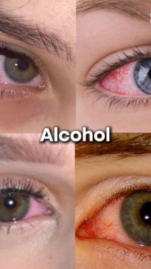 TikTok video thumbnail by kb_mehr_auf_leben1