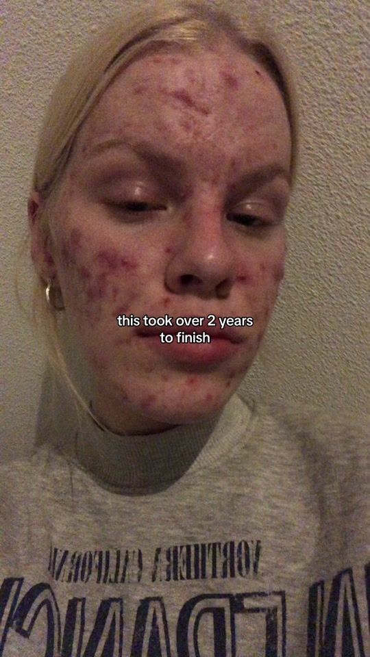 TikTok video thumbnail by pienvandehaar
