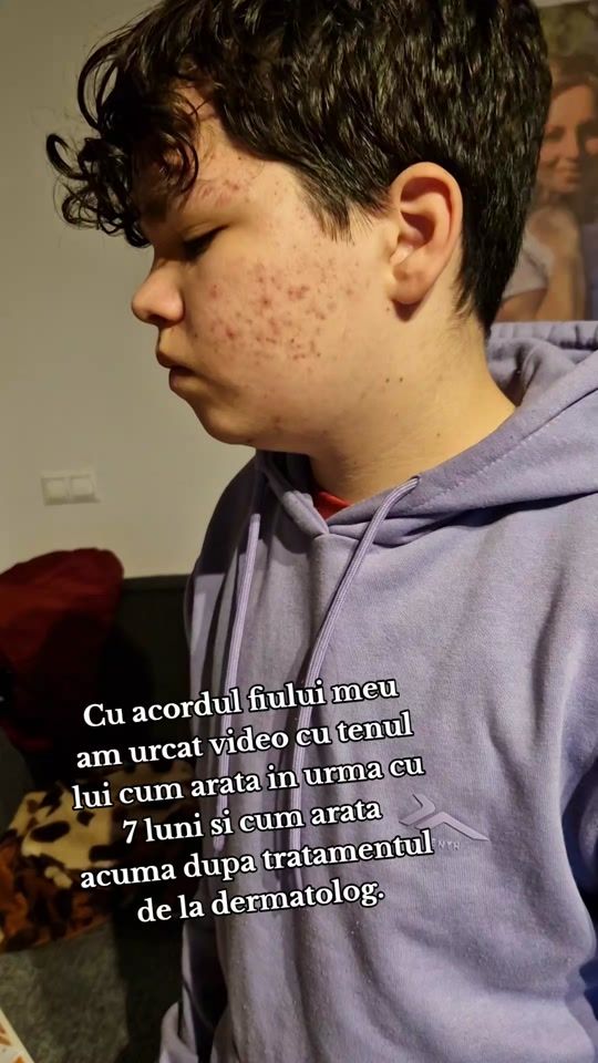 TikTok video thumbnail by melenaely