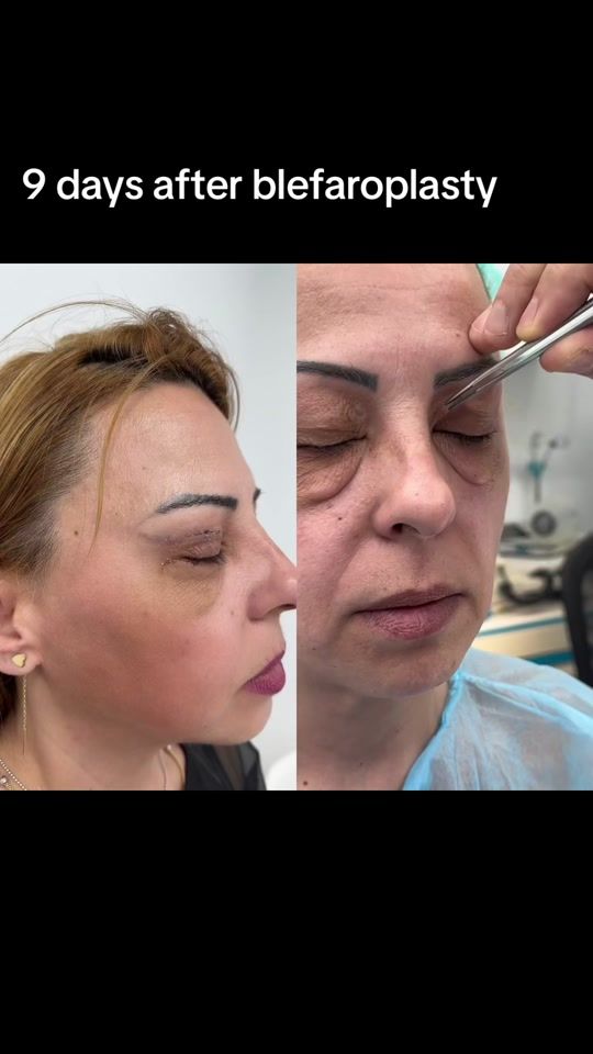 TikTok video thumbnail by dr.levymedicalcenter