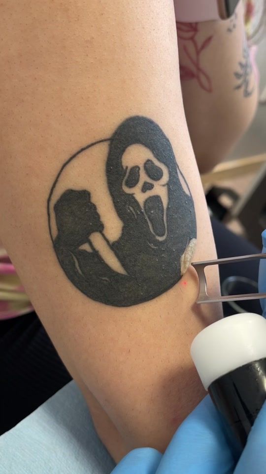 TikTok video thumbnail by clearlasetattooremoval