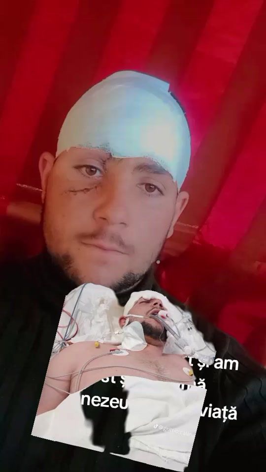 TikTok video thumbnail by florinbosu537