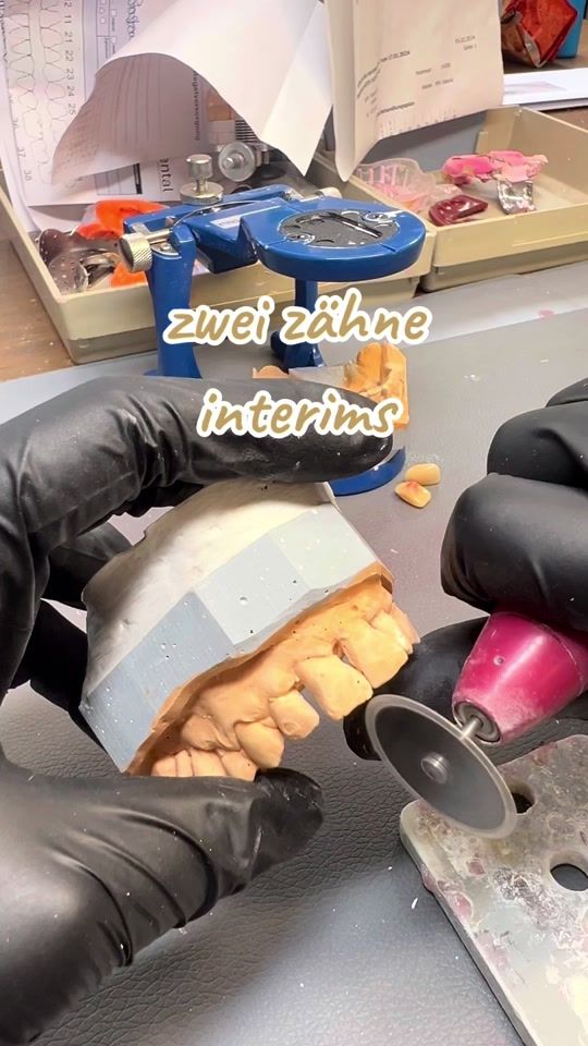TikTok video thumbnail by die.zahntechnikerin