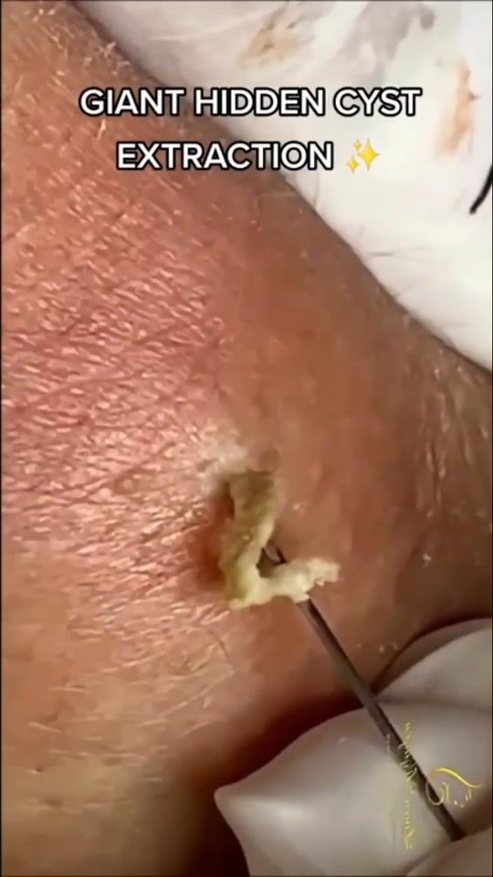TikTok video thumbnail by strangely.satisfiedtv