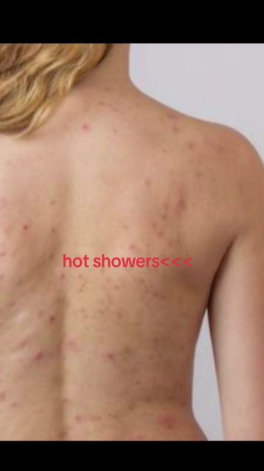 TikTok video thumbnail by chloeqvx