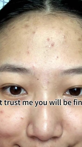 TikTok video thumbnail by mayzinlinhtet7