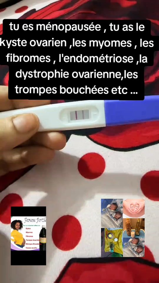 TikTok video thumbnail by dr_agougou