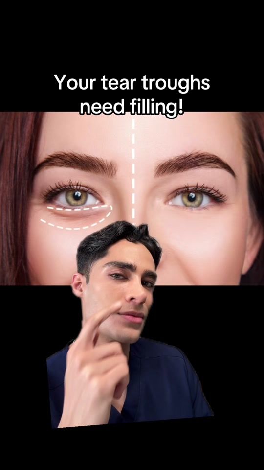 TikTok video thumbnail by drrzayn
