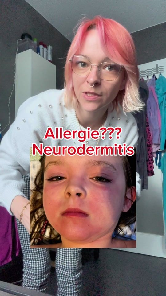 TikTok video thumbnail by unserautist