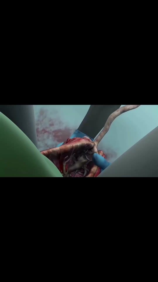 TikTok video thumbnail by zainull267