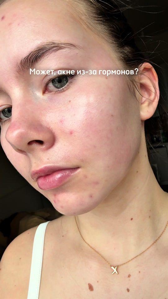 TikTok video thumbnail by mymarriee2