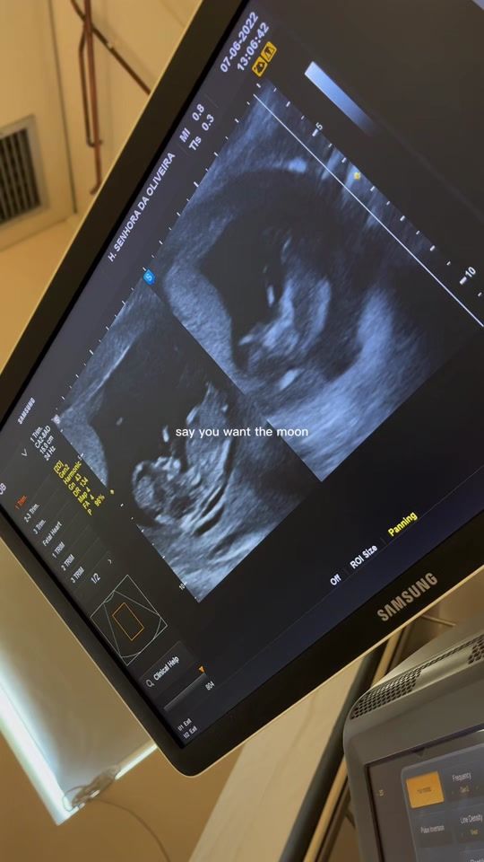 TikTok video thumbnail by 19dii04