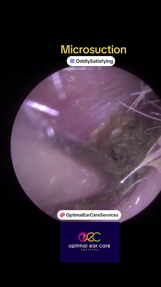 TikTok video thumbnail by optimalearcareservices