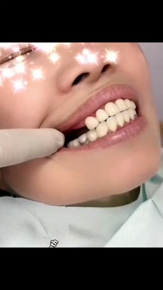 TikTok video thumbnail by dental_artist.offi