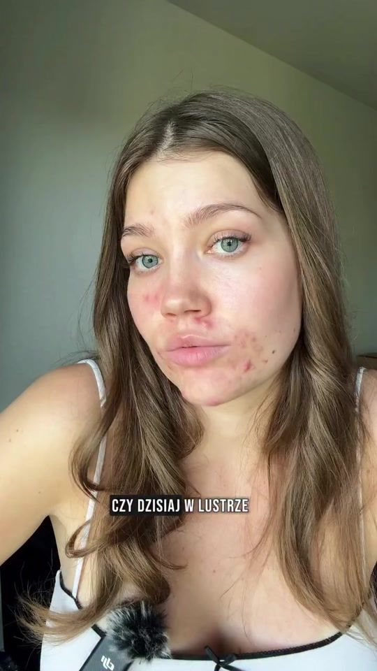 TikTok video thumbnail by bielenda