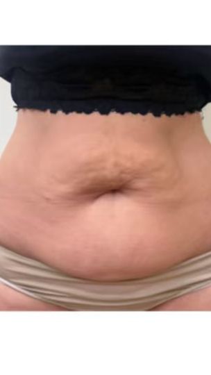 TikTok video thumbnail by beatrizpraca