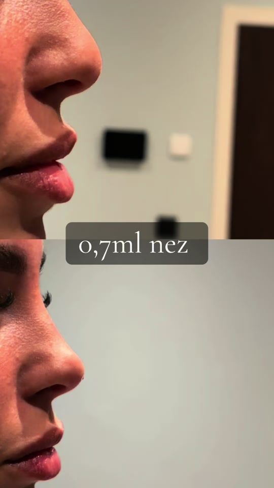 TikTok video thumbnail by sevenaesthetiic