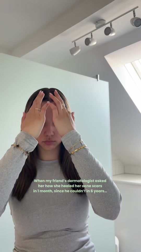 TikTok video thumbnail by and_el6